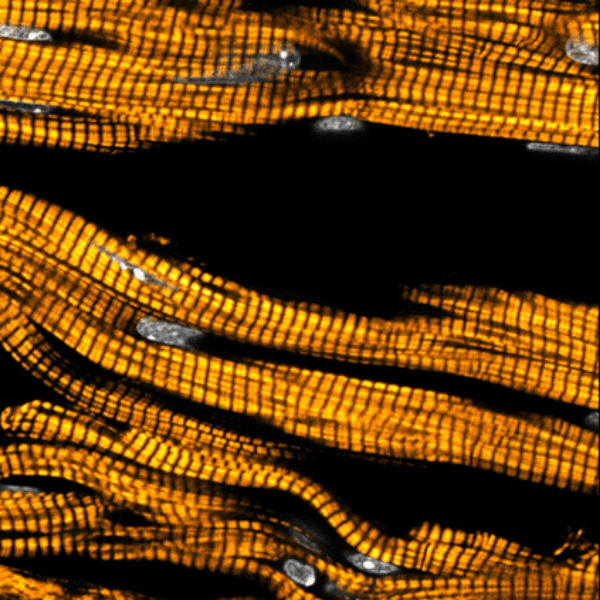 Closeup image of cardiomyocytes