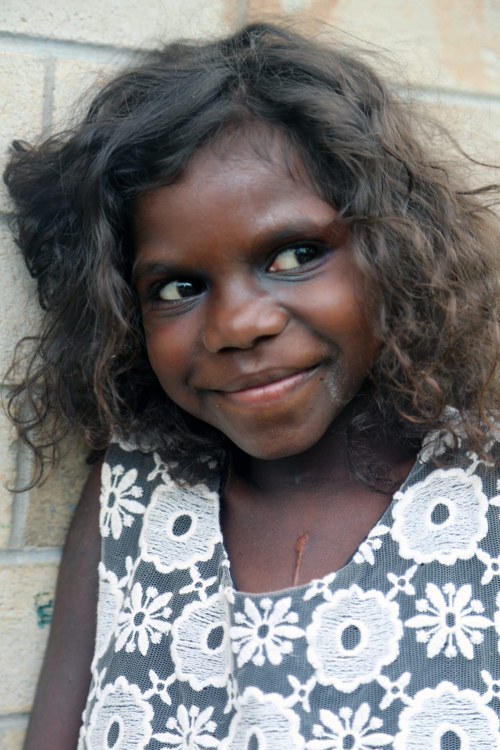 Take Heart_Brooklyn post-op_Darwin Australia_Moonshine Movies